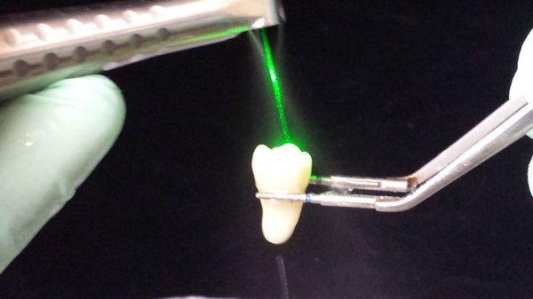 Laser Dentistry