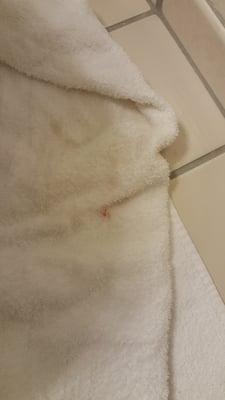 Blood on  towel