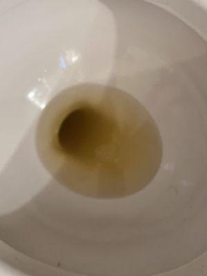 My urine after 3 days on the diet at that horrid place!