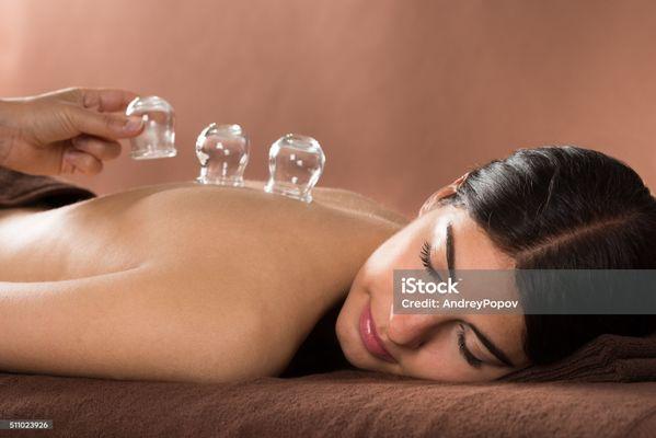 Cupping therapy