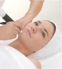 microdermabrasion