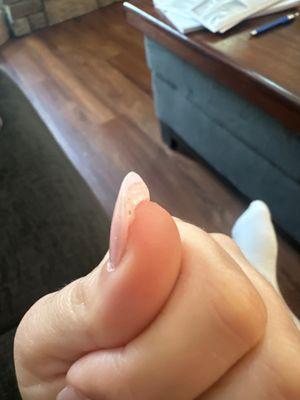 Example of gob of glue under nail