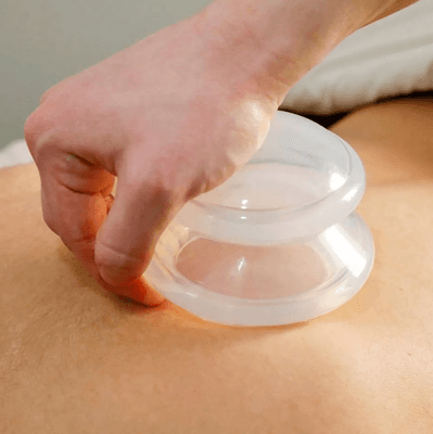 Cupping Massage Therapy