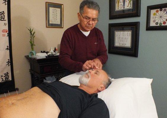 Oro Valley Acupuncture treatment by Acupuncturist Juan Tejada