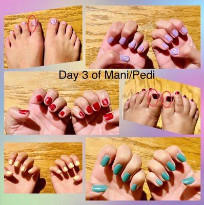 manis/pedis; gel and regular. circled swelling on pedis