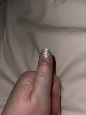 Broken thumb nail before it broke completely and I lost the entire length above the nail bed