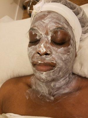 Hyperpigmentation Treatment