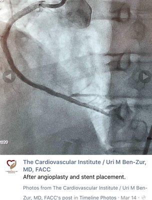 See how the broken line became solid? That's blood flow restored to my heart.. Rock Star doctor!