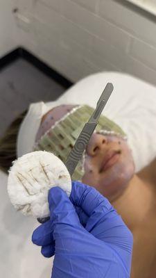 Dermaplaning Facial Service