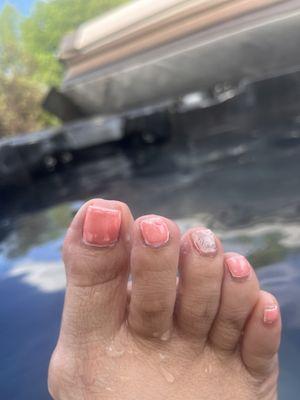 Middle toe missing top color