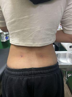 back dermals $170