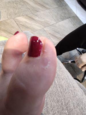 Dead skin after $70 pedi