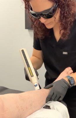 laser spider vein removal with Stephanie!