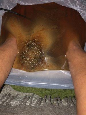 Detox Footbath (September 2021)