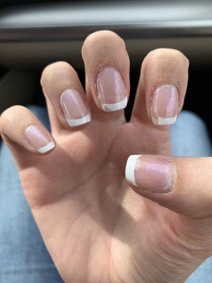 Chipped nails and broken skin around cuticles from manicurist