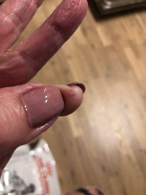 Nail clippers clipped my skin instead of nail.