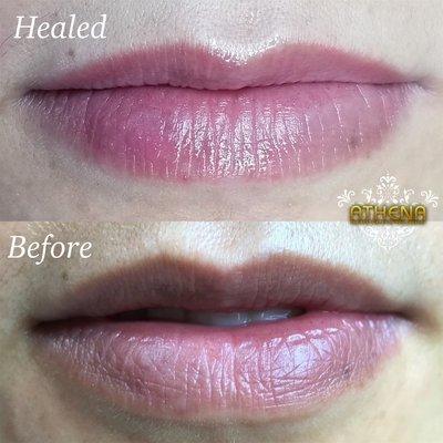 Naturalized dark lips to have healthy pink looking lips