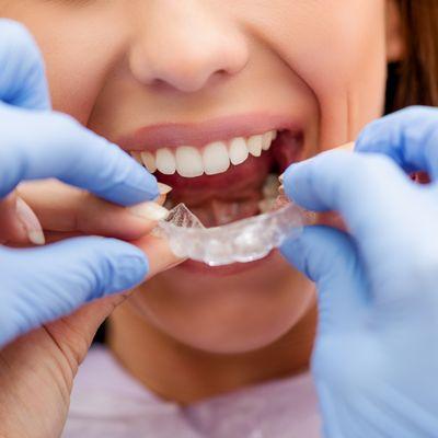 Total Health Dental Care can provide Invisalign clear aligners services