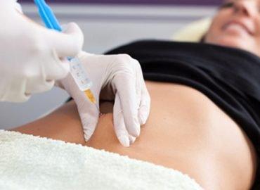 MESOTHERAPY MesoTherapy, is one of the most effective technologies for cellulite and fat reduction.