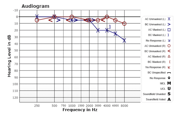 Hearing test results