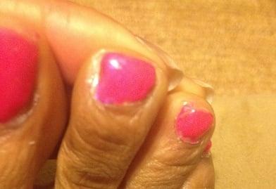 Second and third toes, shellac pedicure.