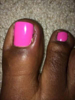 Day Three after my pedicure