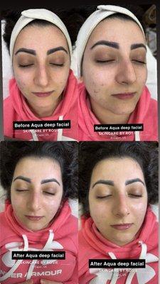 Aqua deep facial