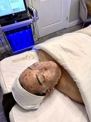 Platinum HydraFacial with Esthemax hydrojelly mask