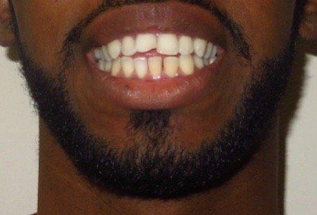 Teeth