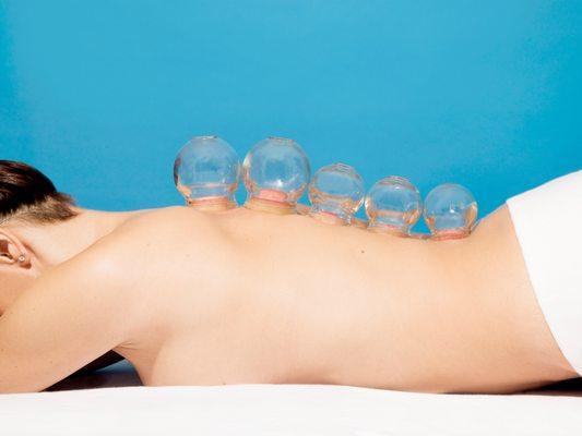 Cupping