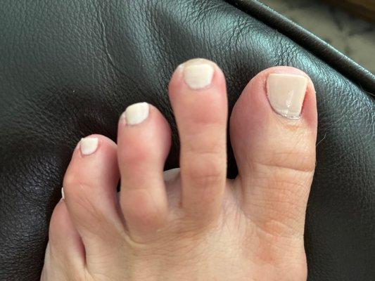 Yucky pedi