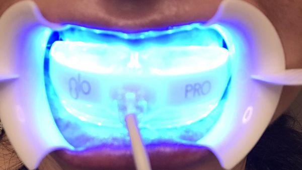 This is the GLO PRO whitening process.