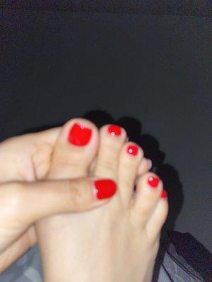 Slanted toe nail