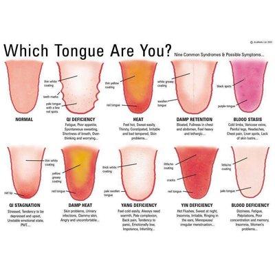 Ever wonder what an acupuncturist is looking at when you stick out your tongue?  This chart, by AcuMedic, explains...