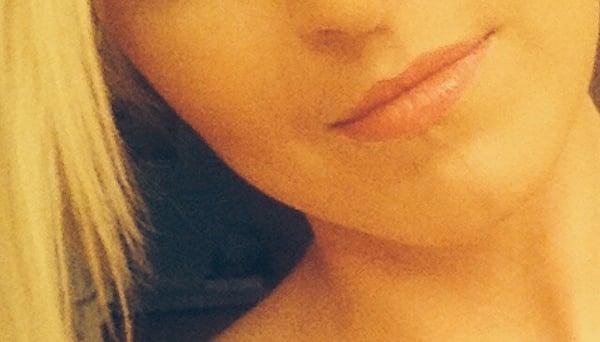 my lips and how normal they looked before this horrific experience