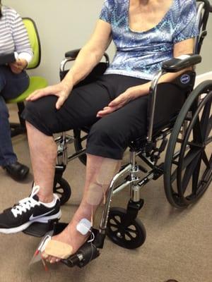 Strokes BEFORE: paralyzed left arm and leg for 10 months; in pain and immobile thru 40 sessions of physical therapy