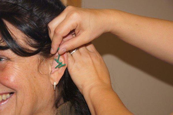 Ear treatments are great for PTSD, addiction, stress and pain.