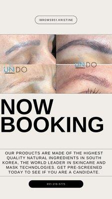 Now offering Undo Removal, a non laser and non saline tattoo removal procedure