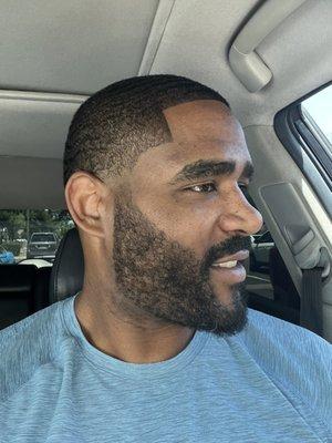 Beard and hairline