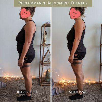 Forward pelvic rotation, tight chest muscles and forward neck posture in the first photo but after 90 minutes, she felt much better.