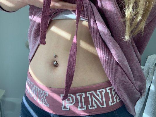 navel piercing (9 months later)