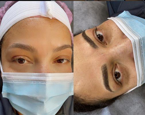 Microblading is suitable if looking for a very natural look. It gives your eyebrows a better shape and a fuller aspect.