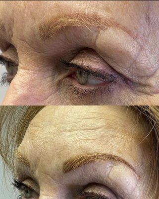 Color correction over old permanent makeup using the powder brow technique. Before (top) & after (bottom). Previous work was not done by me.