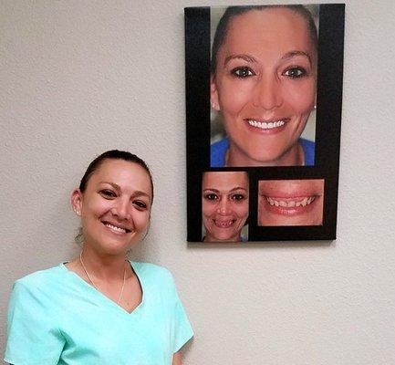 A happy 4M Dental Implant patient on our wall of fame!