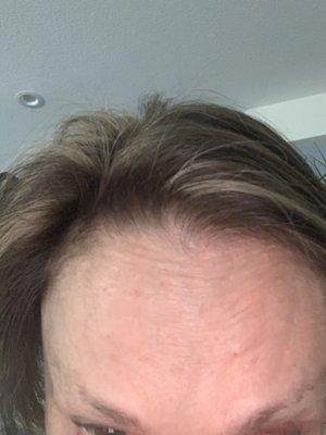 brown spots visible on forehead too   along with wrinkles that usually only show after 3-4 months