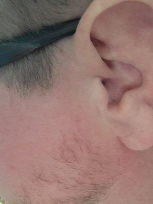 Right sideburn.