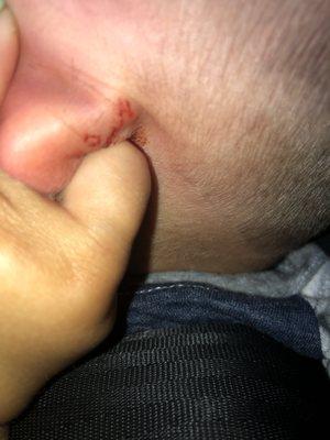 My son has a huge cut on his ear. He's 2. This experience just made him even more scared of getting his hair cut.