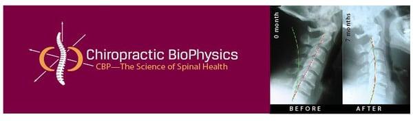 Chiropractic BioPhysics, or CBP, is our technique of choice for spinal correction.