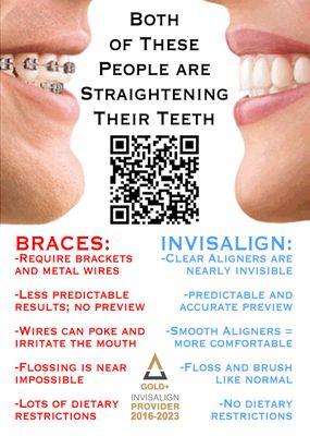 Invisalign vs Braces