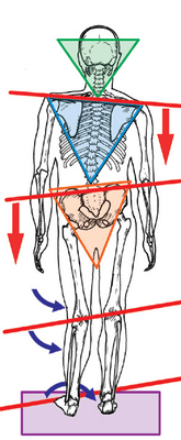 Altered Foot Bio mechanics- affect the entire human frame, which can lead to pain and dysfunction.